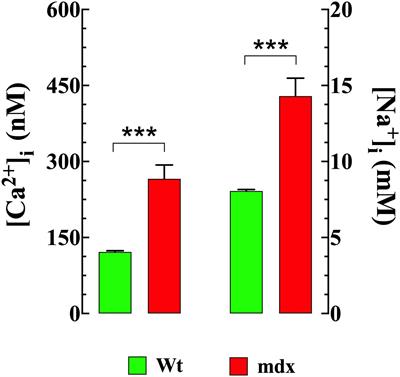 Contribution of TRPC Channels to Intracellular Ca2 + Dyshomeostasis in Smooth Muscle From mdx Mice